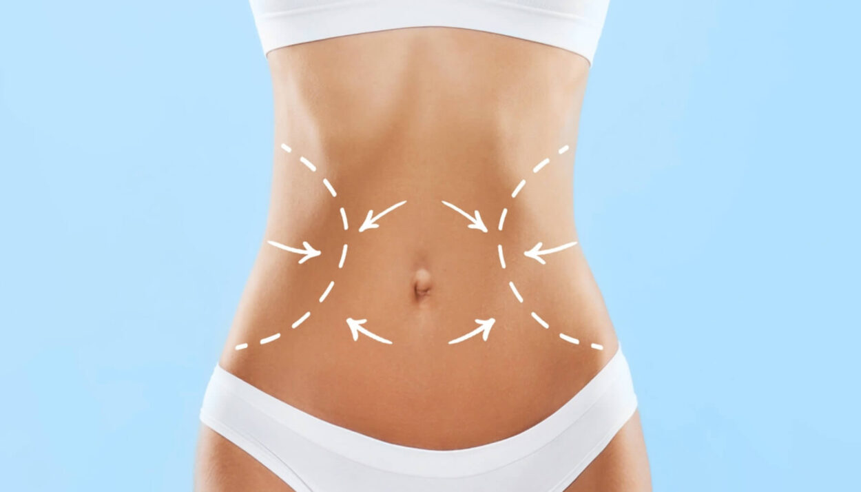 body contouring treatment star aesthetic centre durban 001 a