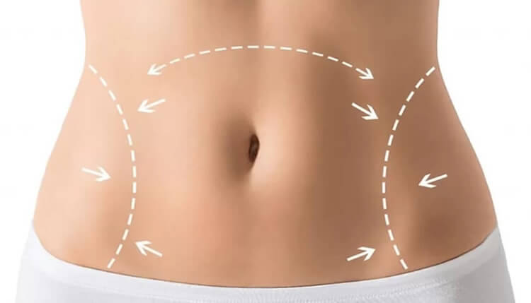 body contouring treatment star aesthetic centre durban 003 750