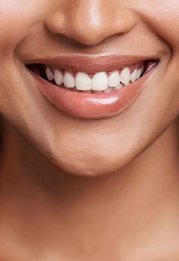 star aesthetic medical center durban lip filler treatment