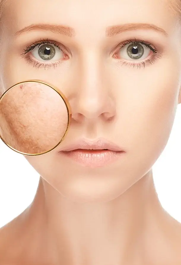 star aesthetic medical centre durban pigmentation treatment pick